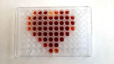 Bioanalytická laboratorní diagnostika ve zdravotnictví